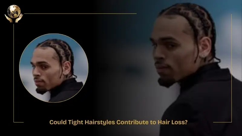 Image showing Chris Brown with tightly braided cornrows, viewed from the side and three-quarter angle, alongside the caption ‘Could Tight Hairstyles Contribute to Hair Loss?’ The visual highlights tension-focused hairstyles that may be associated with traction-related hair loss.