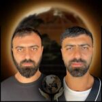 DHI-hair-Transplant-before-and-after