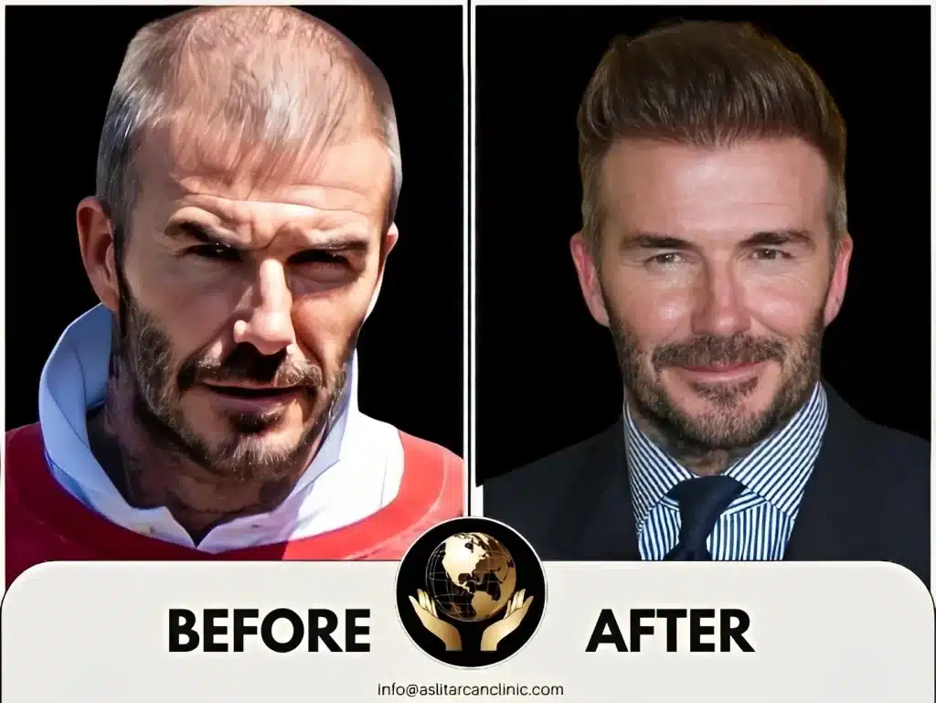 Before And After Transformation of David Beckham