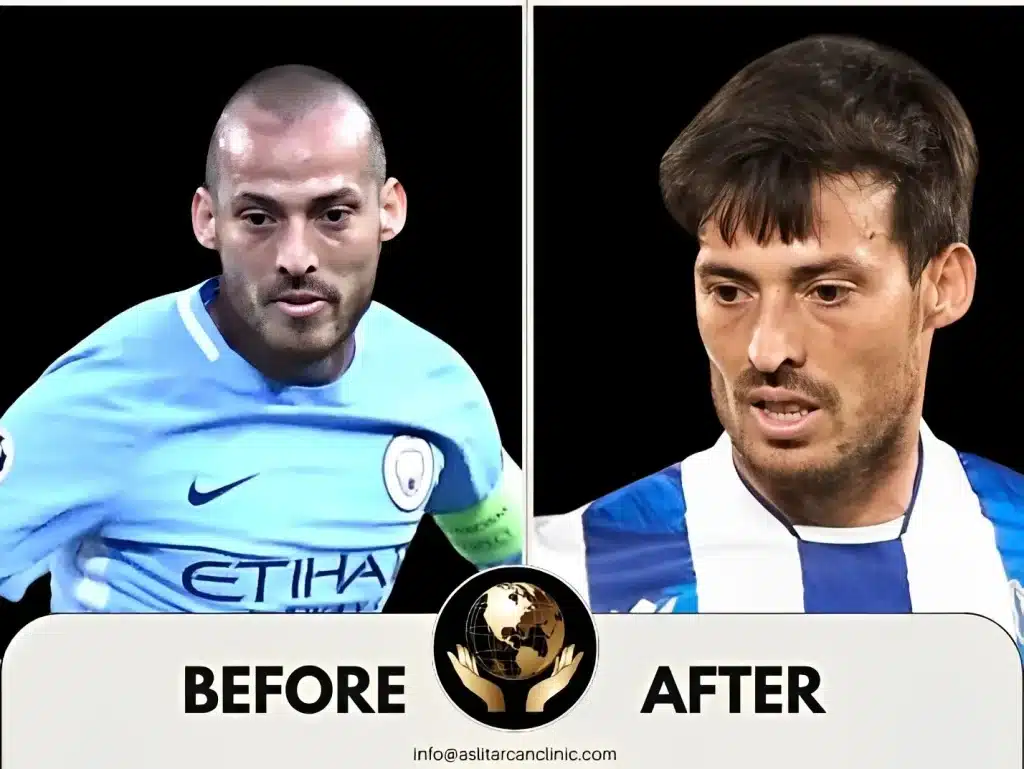 Before And After Transformation of David Silva