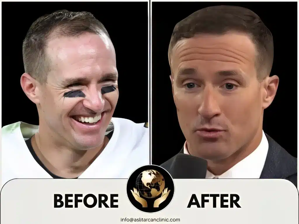 Before And After Transformation of Drew Brees