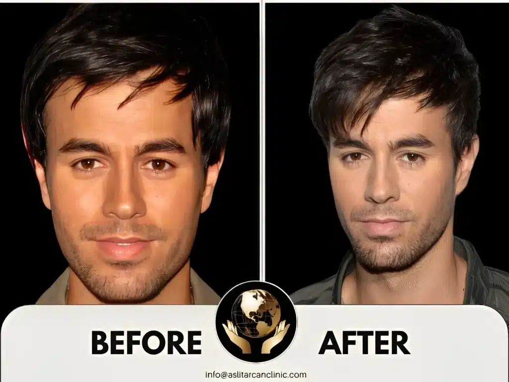 Before And After Transformation of Enrique Inglesias