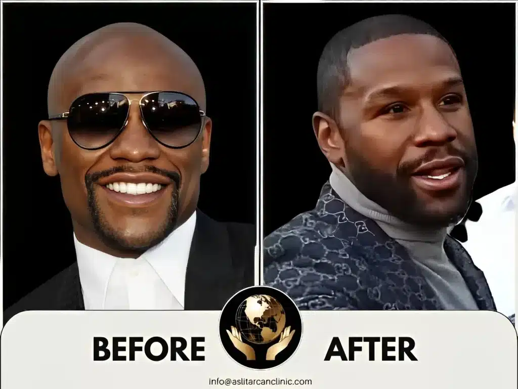 Before And After Transformation of Floyd Mayweather
