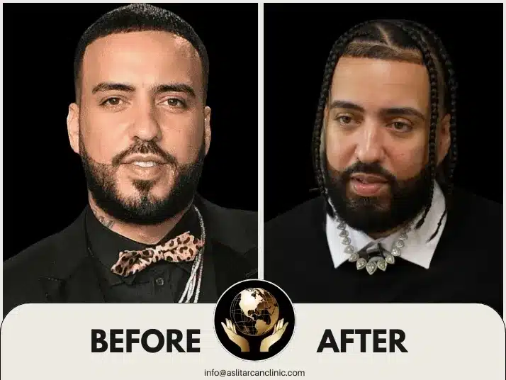 Before And After Transformation of French Montana