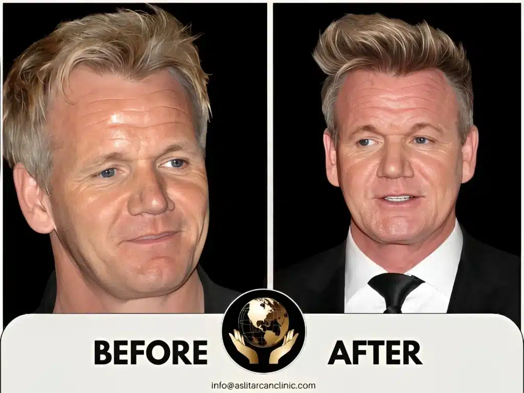 Before And After Transformation of Gordon Ramsay