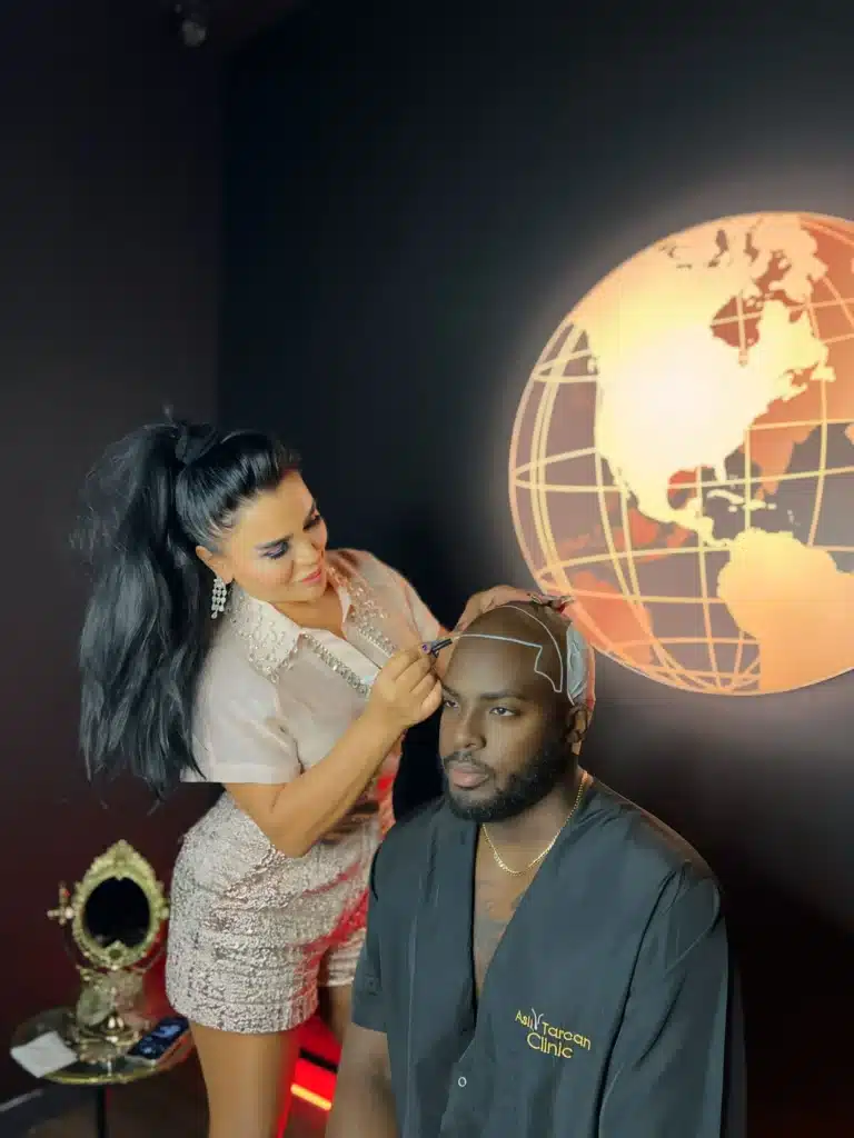 A clinician carefully draws and marks a hairline on a seated man’s shaved scalp before a hair transplant procedure, with the patient wearing a clinic gown and a globe graphic displayed on the wall behind them, emphasizing professional hair restoration planning.