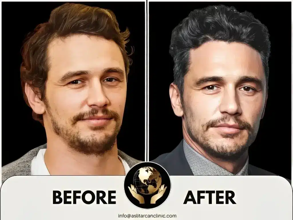 Before And After Transformation of James Franco