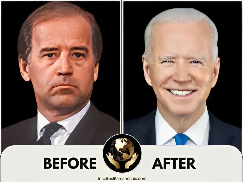 Before And After Transformation of Joe Biden