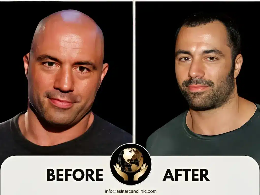 Before And After Transformation of Joe Rogan