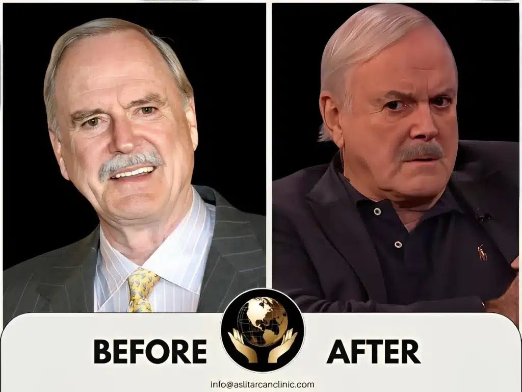 Before And After Transformation of John Cleese