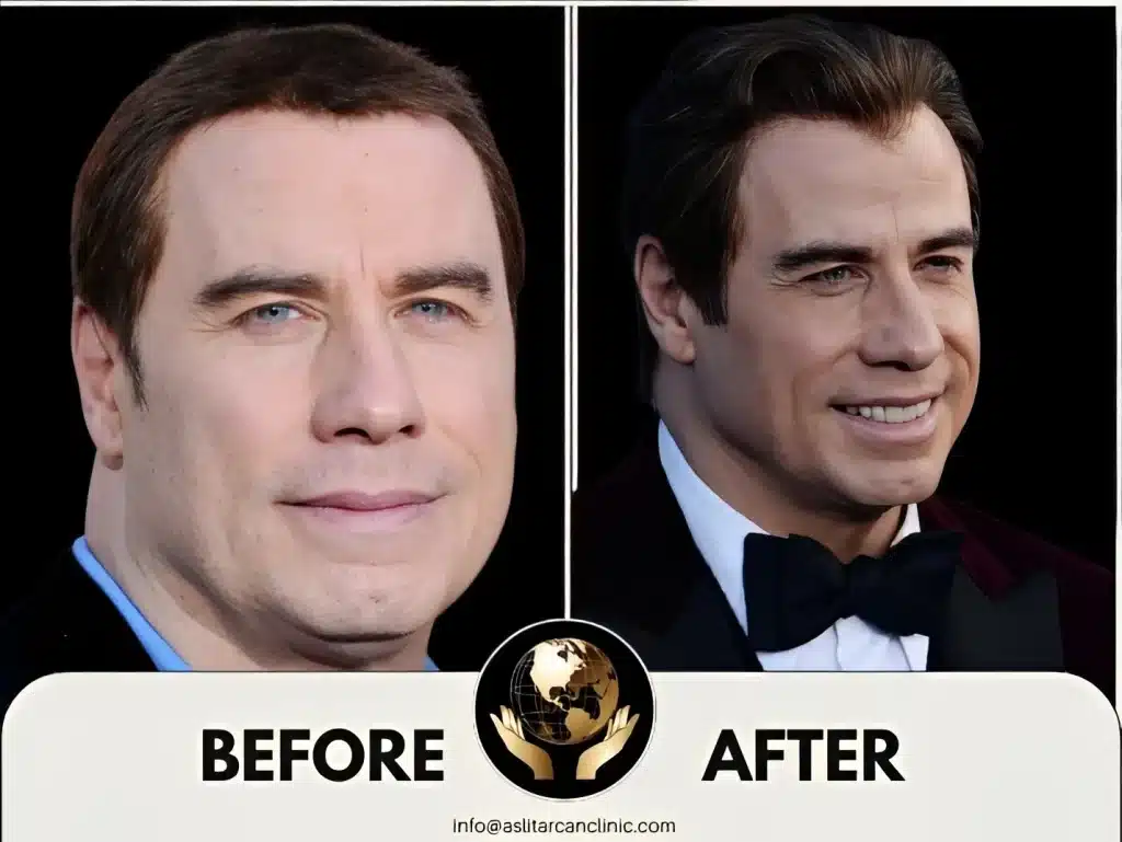 Before And After Transformation of John Travolta
