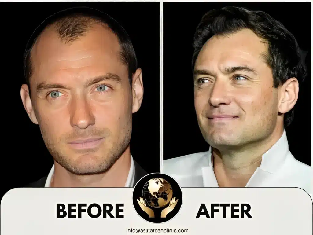 Before And After Transformation of Jude Law
