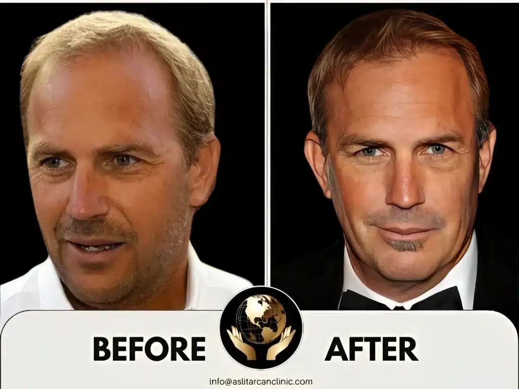 Before And After Transformation of Kevin Costner