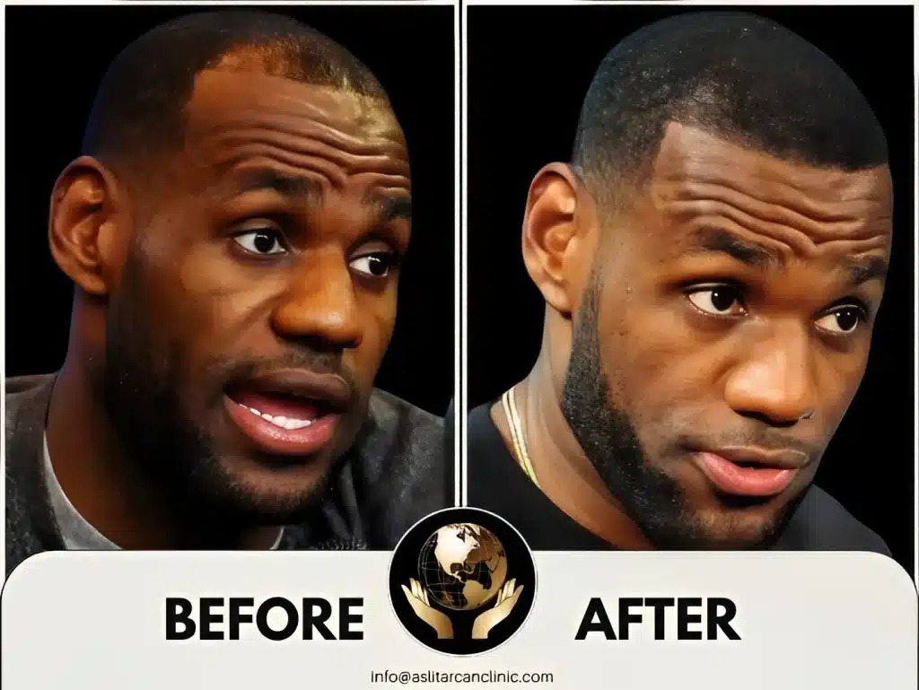 Before And After Transformation of Lebron James