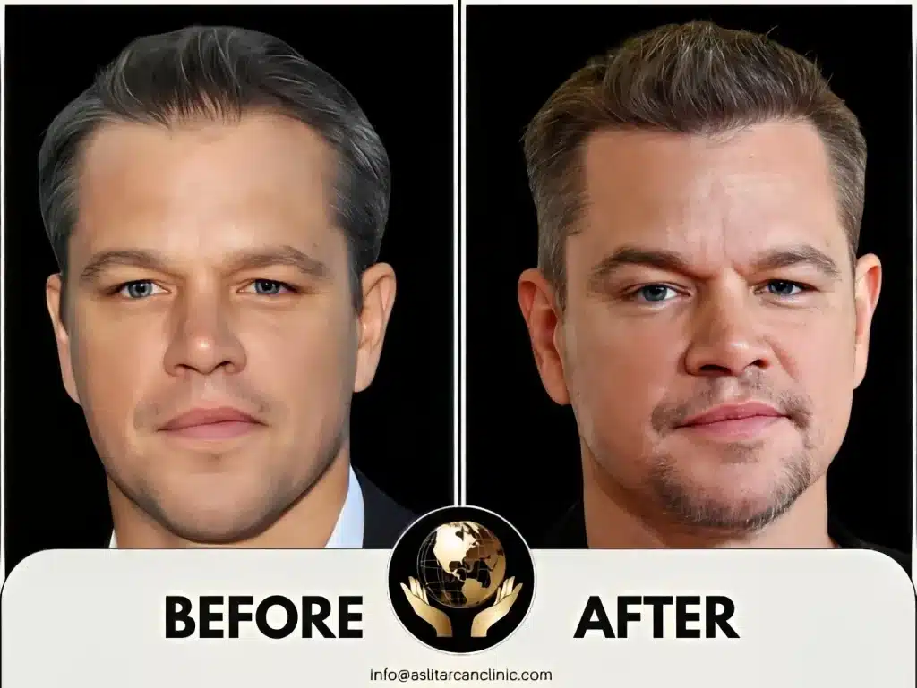 Before And After Transformation of Matt Damon
