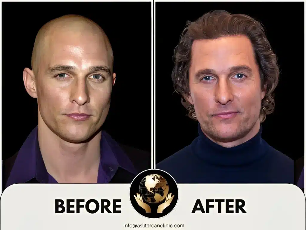 Before And After Transformation of Matthew McConaughey