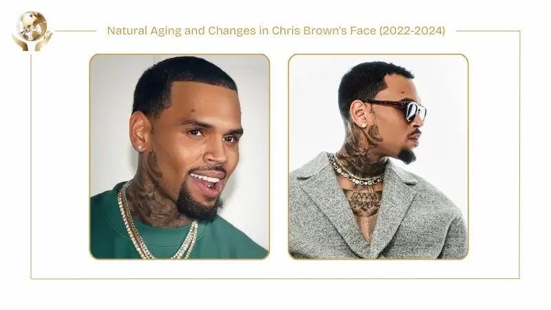 Two side-by-side images titled ‘Natural Aging and Changes in Chris Brown’s Face (2022–2024)’ showing Chris Brown with a short, neatly groomed haircut. The left image shows him smiling in a front-facing portrait, while the right image shows a profile view wearing sunglasses and layered jewelry, highlighting subtle facial changes and mature features over time.