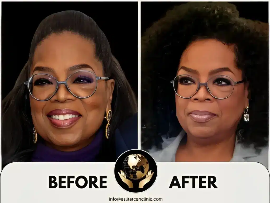 Before And After Transformation of Oprah Winfrey