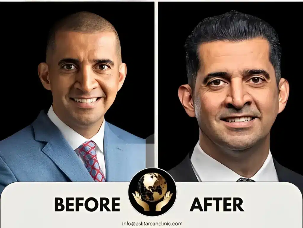 Before And After Transformation of Patrick Bet David