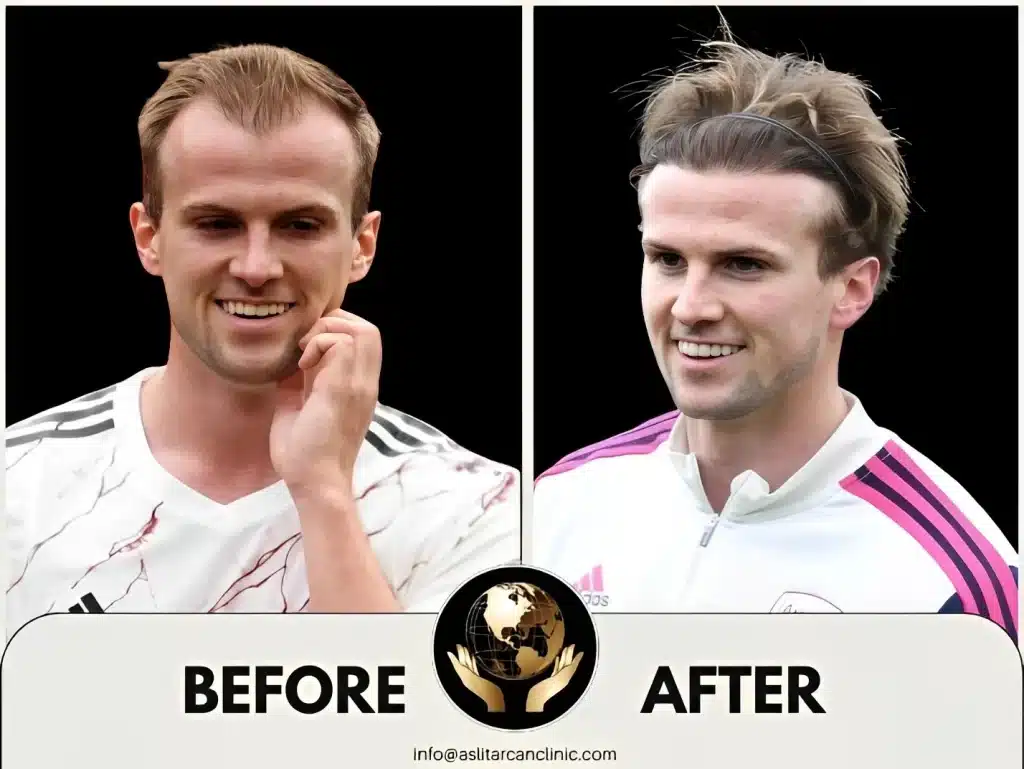 Before And After Transformation of Rob Holding