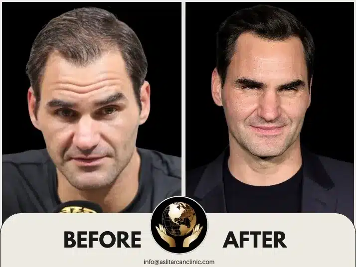 Before And After Transformation of Roger Federer