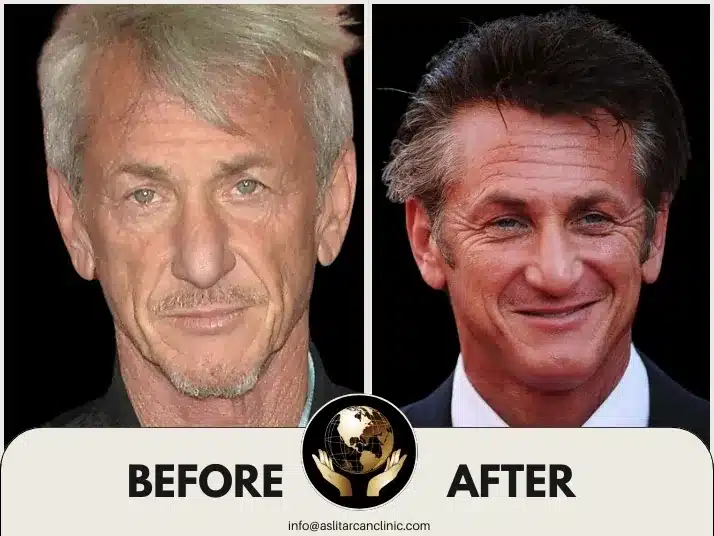 Before And After Transformation of Sean Penn