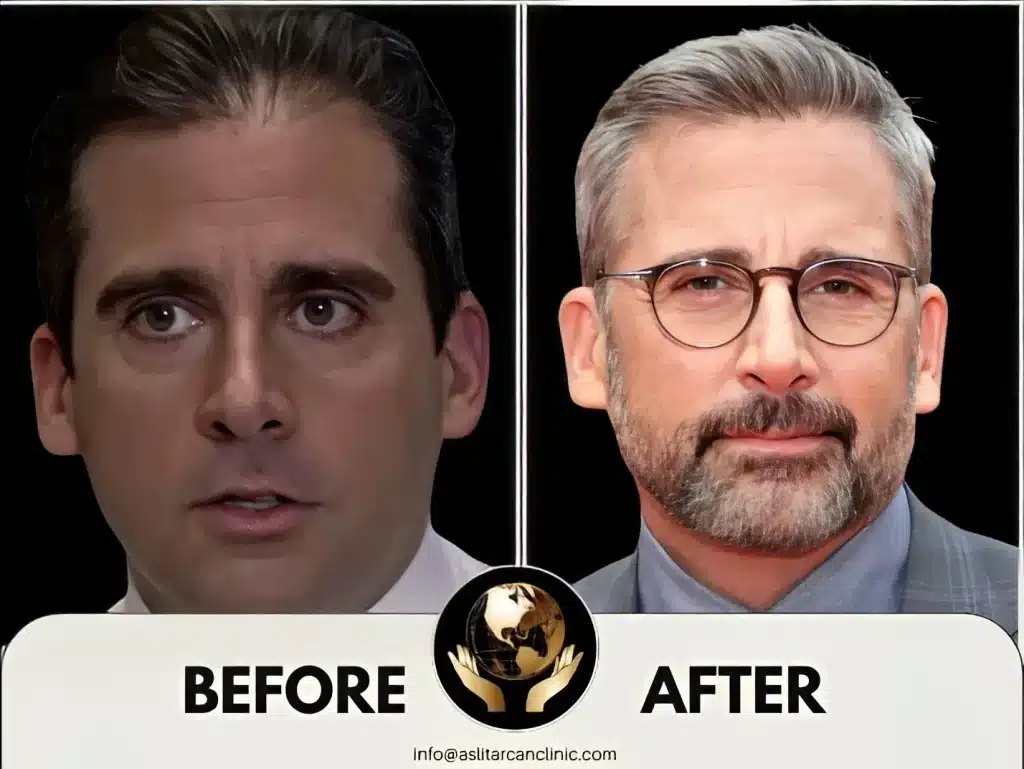 Before And After Transformation of Steve Carell