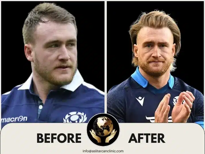 Before And After Transformation of Stuart Hogg