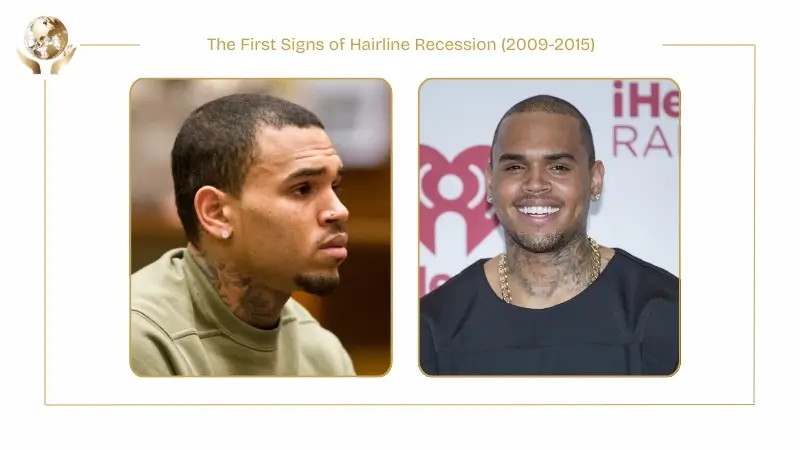 Side-by-side images titled ‘The First Signs of Hairline Recession (2009–2015)’ showing Chris Brown during this period. The left image shows him in profile with short hair and a slightly receding hairline, while the right image shows him smiling at an event with a closely cropped hairstyle, highlighting early signs of hairline recession.