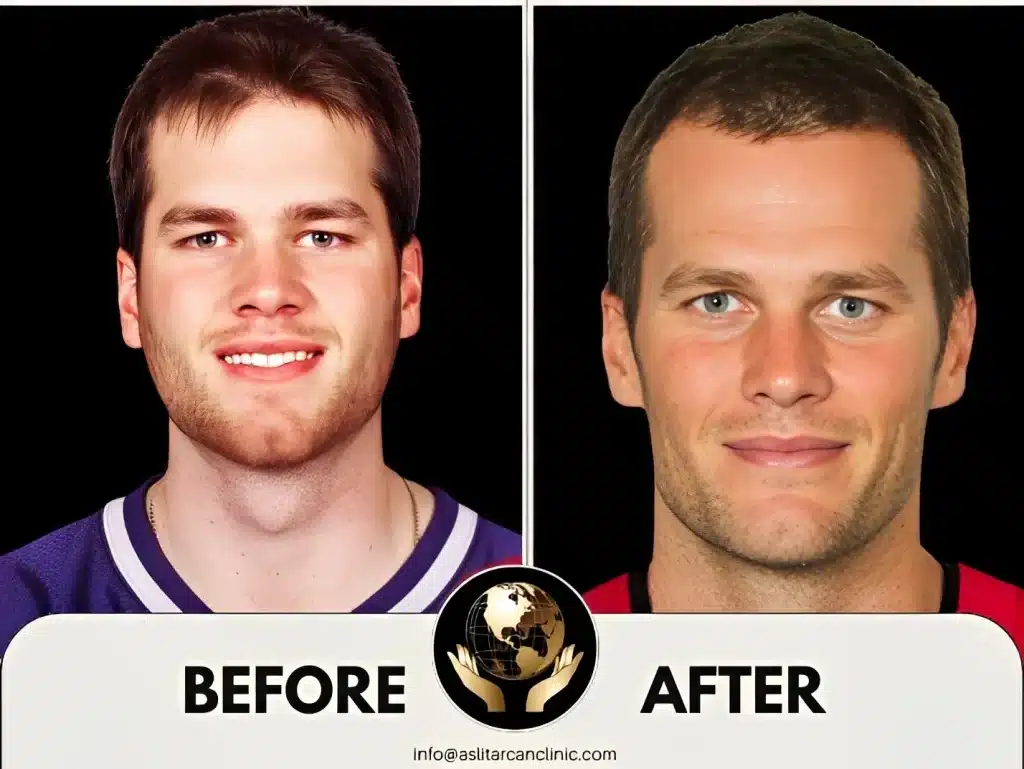 Before And After Transformation of Tom Brady