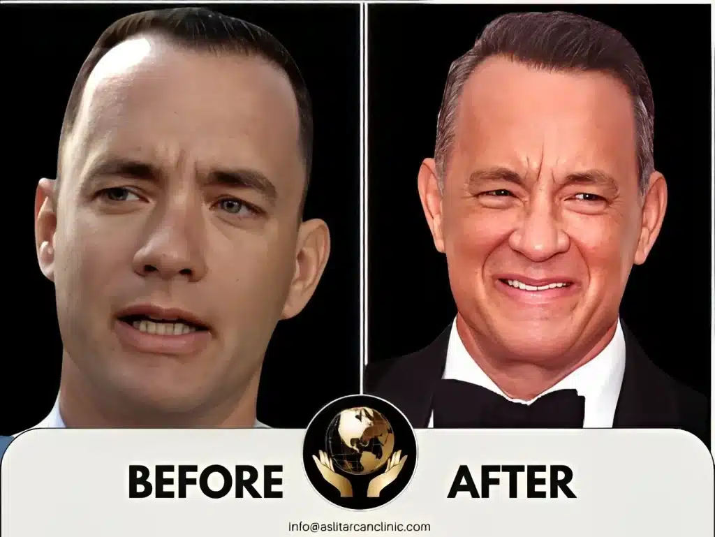 Before And After Transformation of Tom Hanks