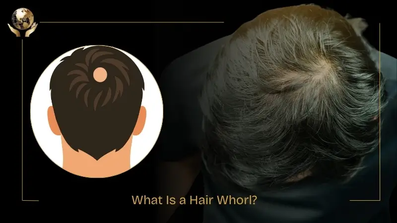 Graphic explaining a hair whorl, showing an illustrated crown swirl next to a real photo of a natural hair whorl at the top of the head.