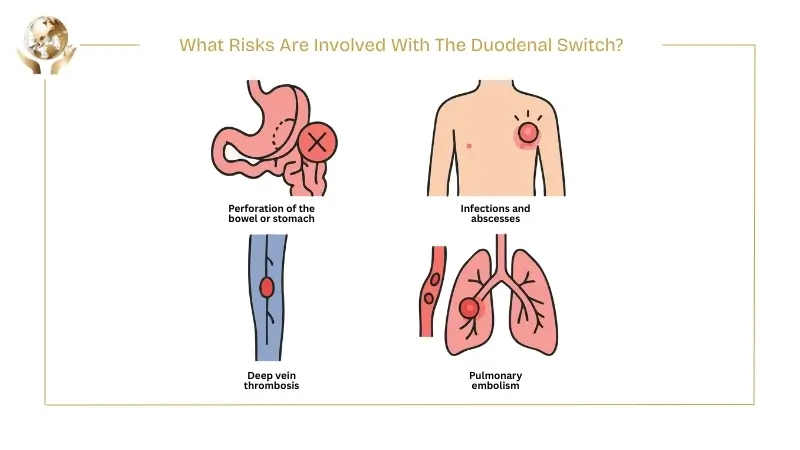 Illustration showing risks of duodenal switch surgery, including bowel or stomach perforation, infections, deep vein thrombosis, and pulmonary embolism.