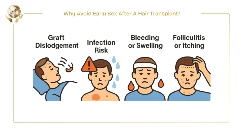 Infographic explaining why early sex after a hair transplant should be avoided, highlighting risks such as graft dislodgement, infection, bleeding or swelling, and folliculitis or itching.