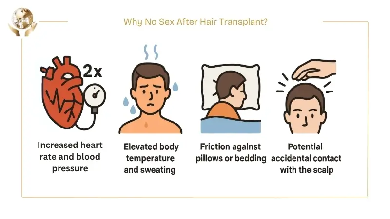 Illustration explaining why sex is discouraged after a hair transplant, showing increased heart rate and blood pressure, sweating, friction against bedding, and risk of accidental scalp contact.