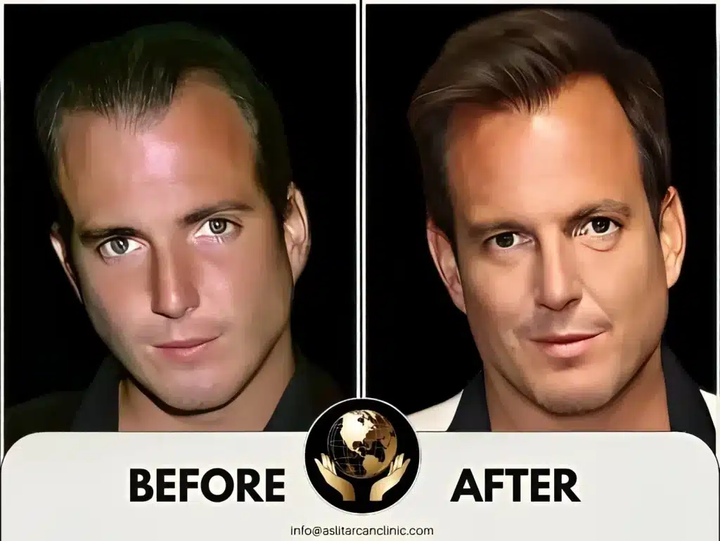Before And After Transformation of Will Arnett