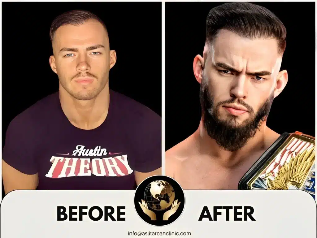 Before And After Transformation of Austin Theory