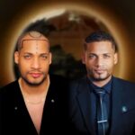 hair-transplant-in-turkey-before-and-after