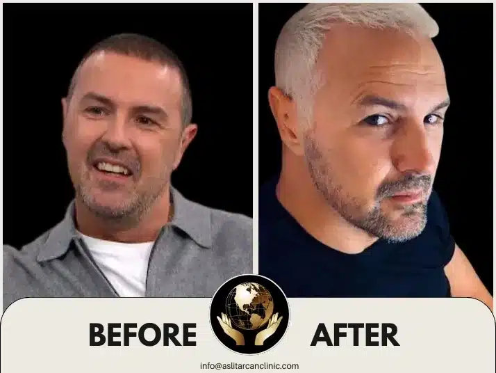 Before And After Transformation of Paddy McGuinness
