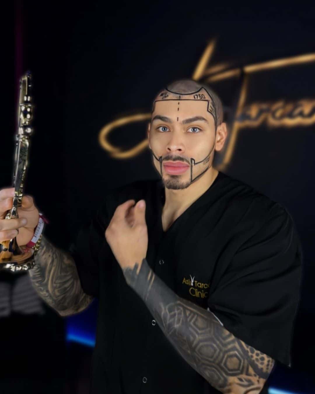 Hero for Beard Transplant in Turkey