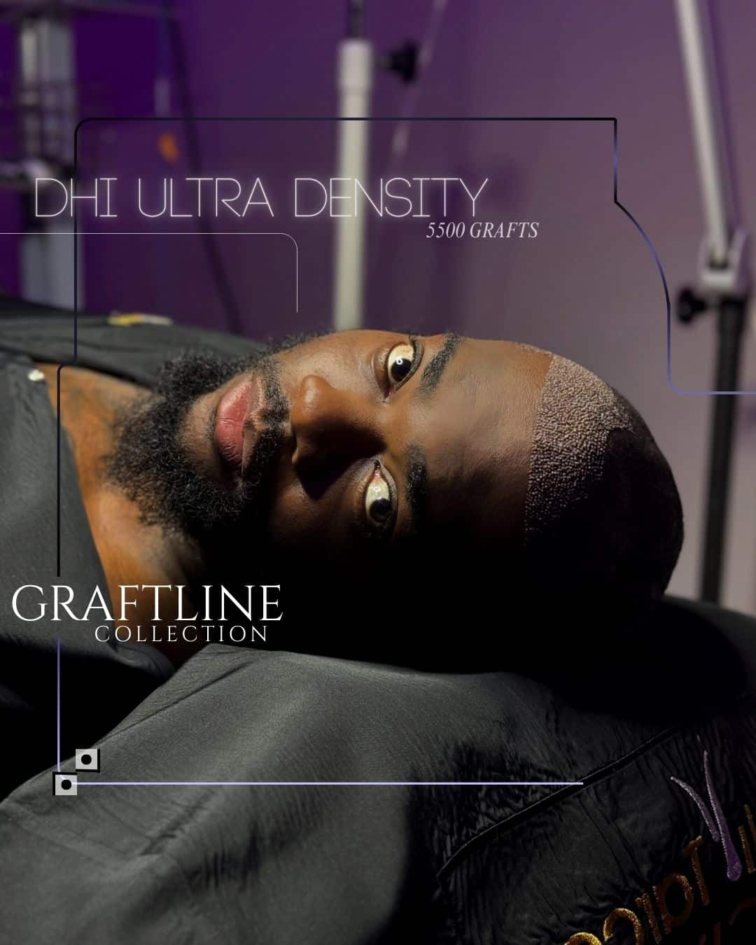 Promotional image of a DHI hair transplant procedure showing a man lying back with a closely shaved scalp and visible ultra-dense graft placement, labeled “DHI Ultra Density – 5500 grafts” from the Graftline Collection, in a clinical studio setting with purple tones.