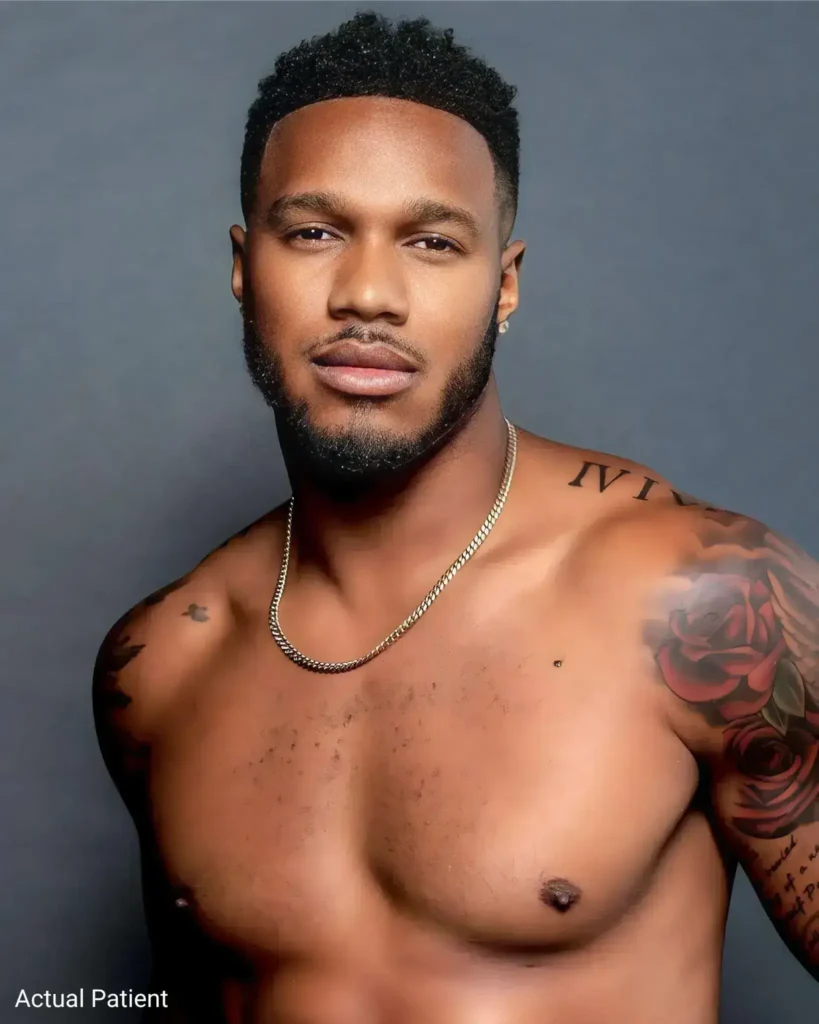 Porträt eines zufriedenen Patienten mit dichtem, natürlich wirkendem Haaransatz und gleichmäßigem Bartwuchs, sichtbares ästhetisches Ergebnis nach Haar- und Barttransplantation.