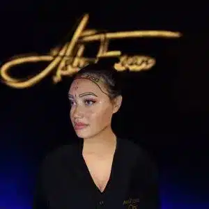 Vorschaubild für Haartransplantation bei Frauen