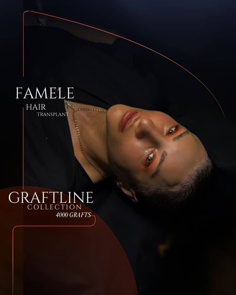 A woman is shown reclining in a dark, refined setting, highlighting a smooth, naturally restored hairline.