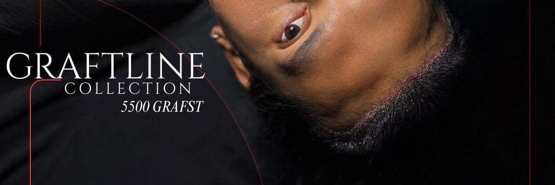 Close-up image of a natural grafted hairline after a no-shave hair transplant, shown from an angled view, highlighting dense, precise graft placement and realistic hair growth, with text reading “Graftline Collection – 5500 Grafts.”
