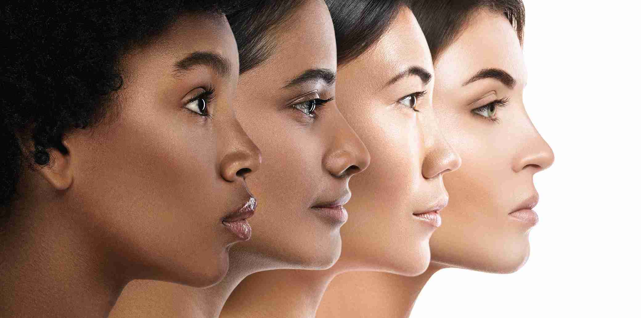 Side profiles of four women with different nose shapes, illustrating Types of Rhinoplasty and aesthetic nose variations.