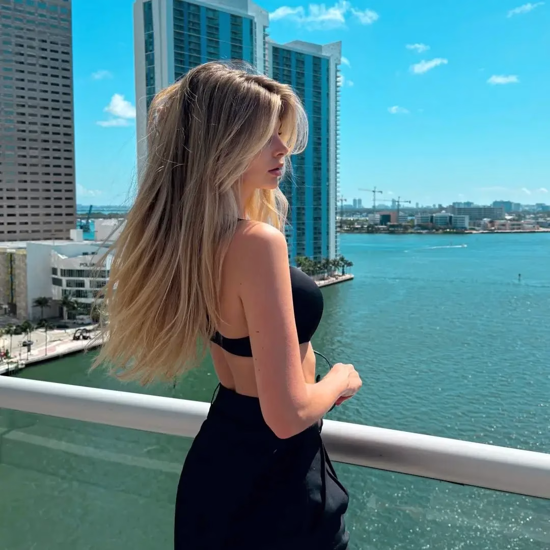 8 3 year result of revision rhinoplasty at asli tarcan clinic