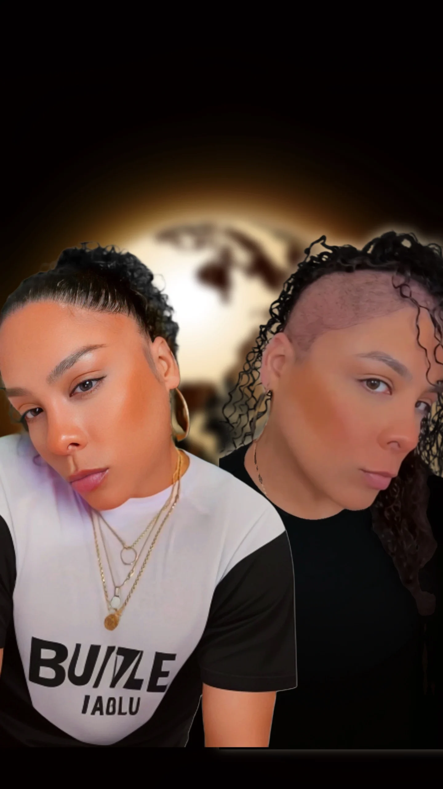 7 Female hair transplant before and after