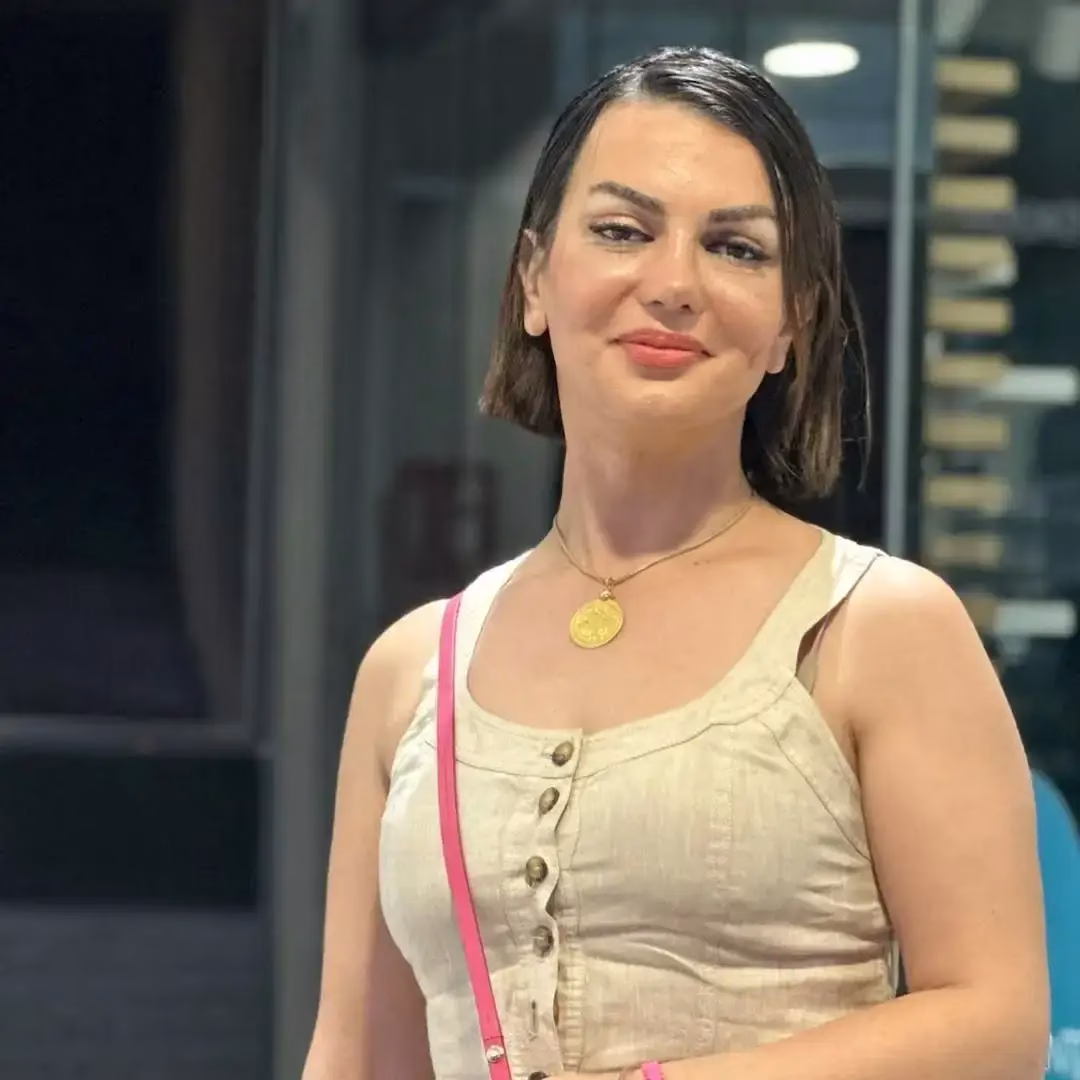 12 Actual nose job results