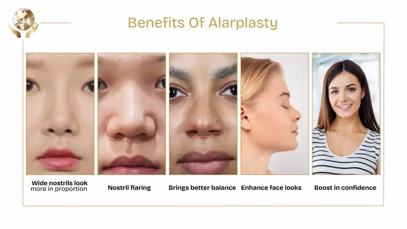 Alar Base Reduction: From Wide Nostrils to Refined Features 5 Benefits Of Alarplasty